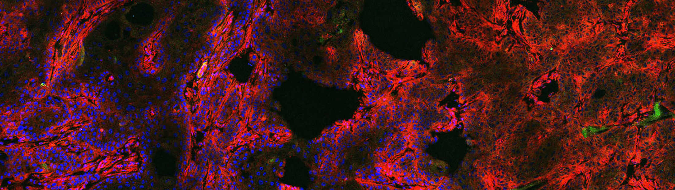 a microscopic image of a human tumor xenograft with a fluorescent red dye that reveals cancerous cells on tumors