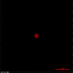 The two-compartment nanoparticles as seen with fluorescence microscopy.