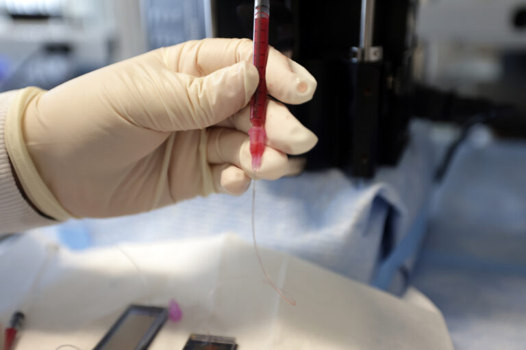 A thin, transparent syringe is filled with crimson blood and connected to GO chips by a thin plastic thread. The syringe is held in a gloved hand over the chips, which rest on a benchtop.